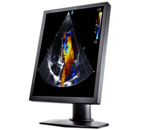 Double Black Imaging 2MP Color Clinical LCD